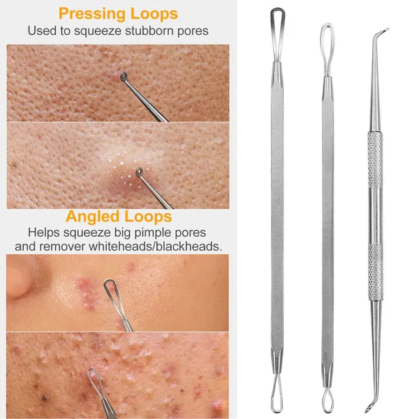 Blackhead Remover Kit - 7pcs